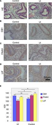 The Roles of Anandamide, Fatty Acid Amide Hydrolase, and Leukemia Inhibitory Factor on the Endometrium during the Implantation Window